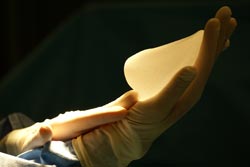 Powiększanie piersi - implanty