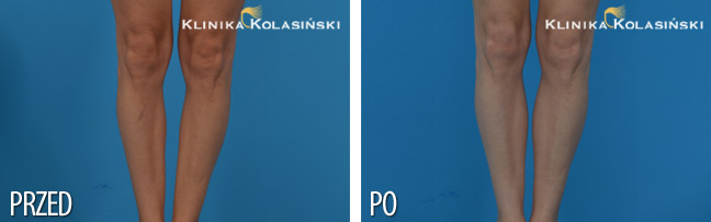 Klinika Kolasiński - bilder vorher und nachher