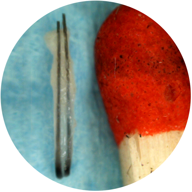Przeszczep włosów technika hybrydowa - Przeszczep włosów z zapałką